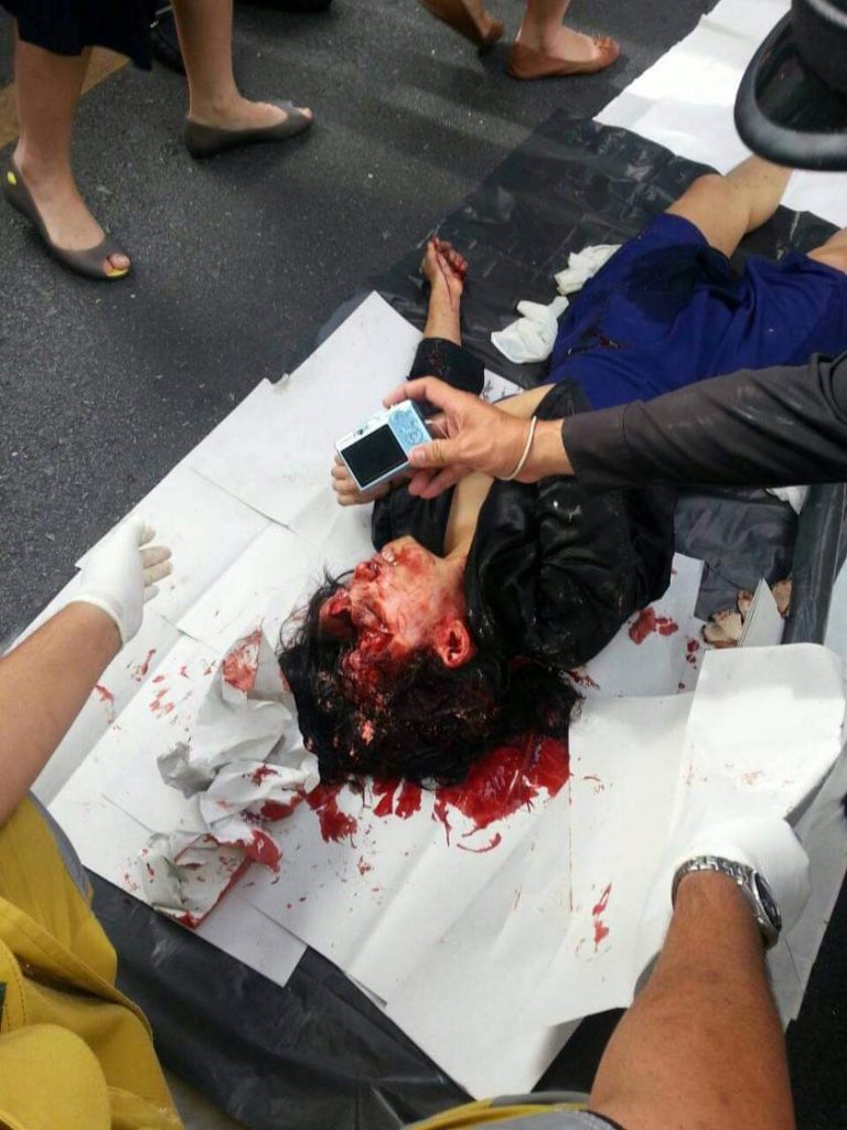 Mujer tailandesa de 24 años con la cabeza aplastada por camion.jpg