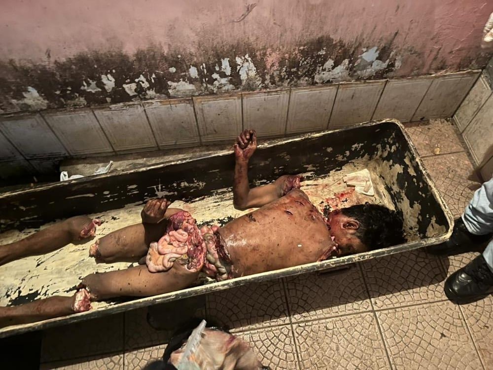 xgore-Man-found-dismembered-in-Brazil-t34we-1.jpg