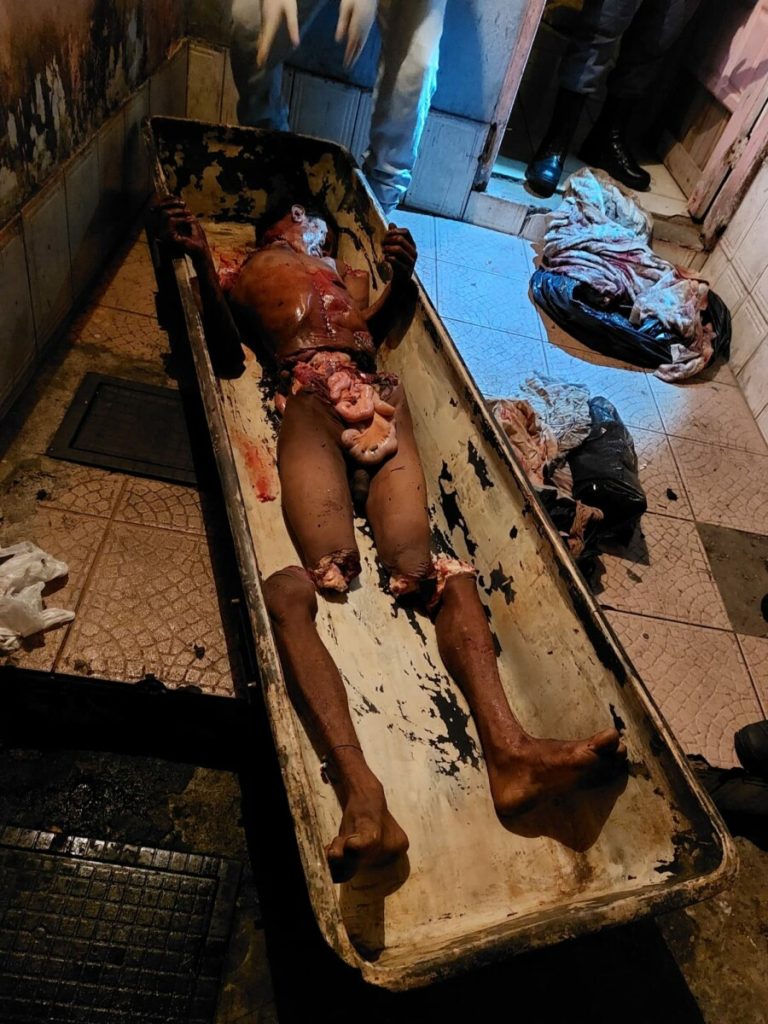 xgore-Man-found-dismembered-in-Brazil-t34we-2-768x1024.jpeg